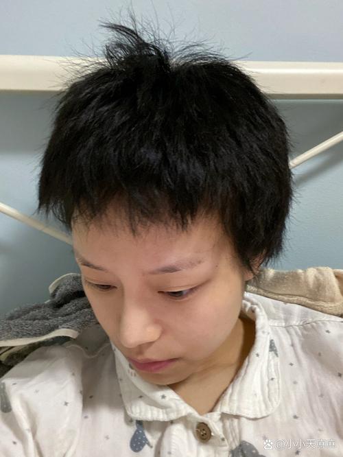 剃完头发多久能长出来_剃光头多久长出头发？速度与护理