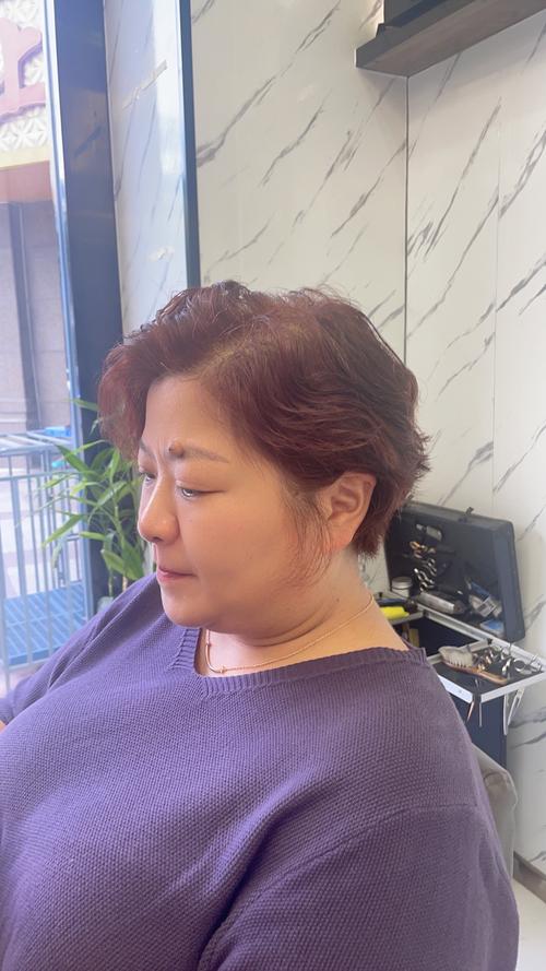 胖了头发会变少吗_肥胖可能导致脱发，激素失衡营养吸收差等因素影响头发健康改善饮食增加运动调节情绪有助于改善脱发