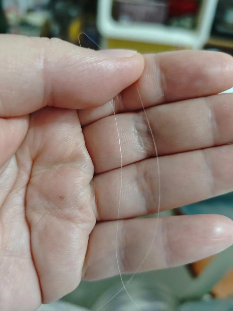 才33岁突然有一根白头发_33岁长白发？别慌，多是遗传，调整生活或可延缓