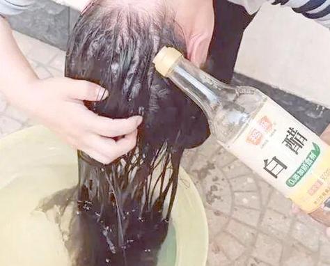 陈醋洗头发的正确方法_陈醋水洗头，清爽去屑，每周1-2次