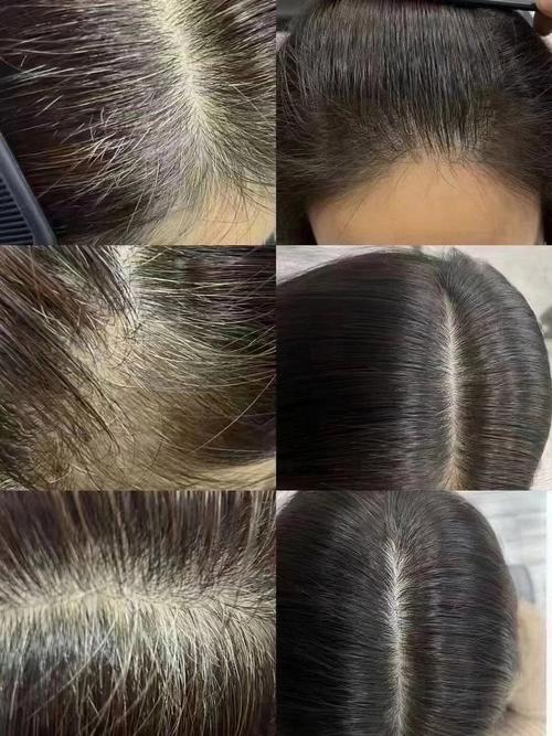 人老了头发为什么会变白_遗传衰老伤身，饮食减压护头皮