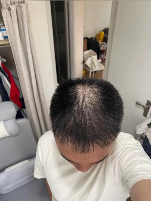 主不许可一根头发_珍惜生命，敬畏神，不过度追求物质