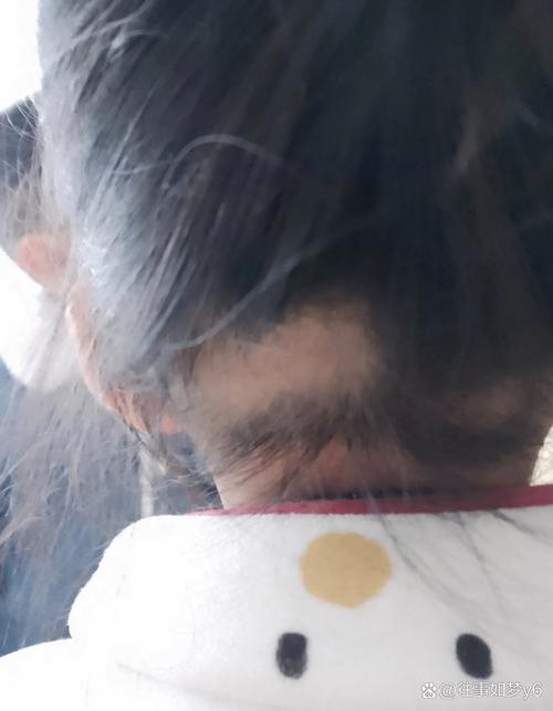 神若不许可一根头发不得掉在地上_神许不掉发,现实总脱发,情路起起伏伏,珍惜眼前人 神若不许可一根头发不得掉在地上_神许不掉发,现实总脱发,情路起起伏伏,珍惜眼前人