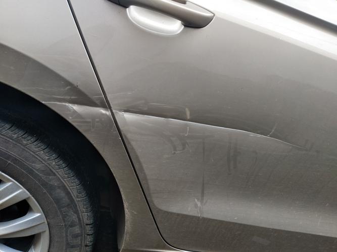 皮肉擦伤有点深看到灰色是什么_伤口变灰?别慌,可能是这几种情况! 皮肉擦伤有点深看到灰色是什么_伤口变灰?别慌,可能是这几种情况!