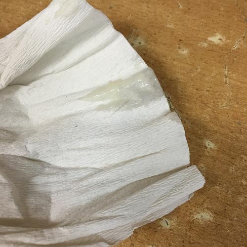 流出来的白色液体是什么_女性白带正常与异常解析及预防 流出来的白色液体是什么_女性白带正常与异常解析及预防